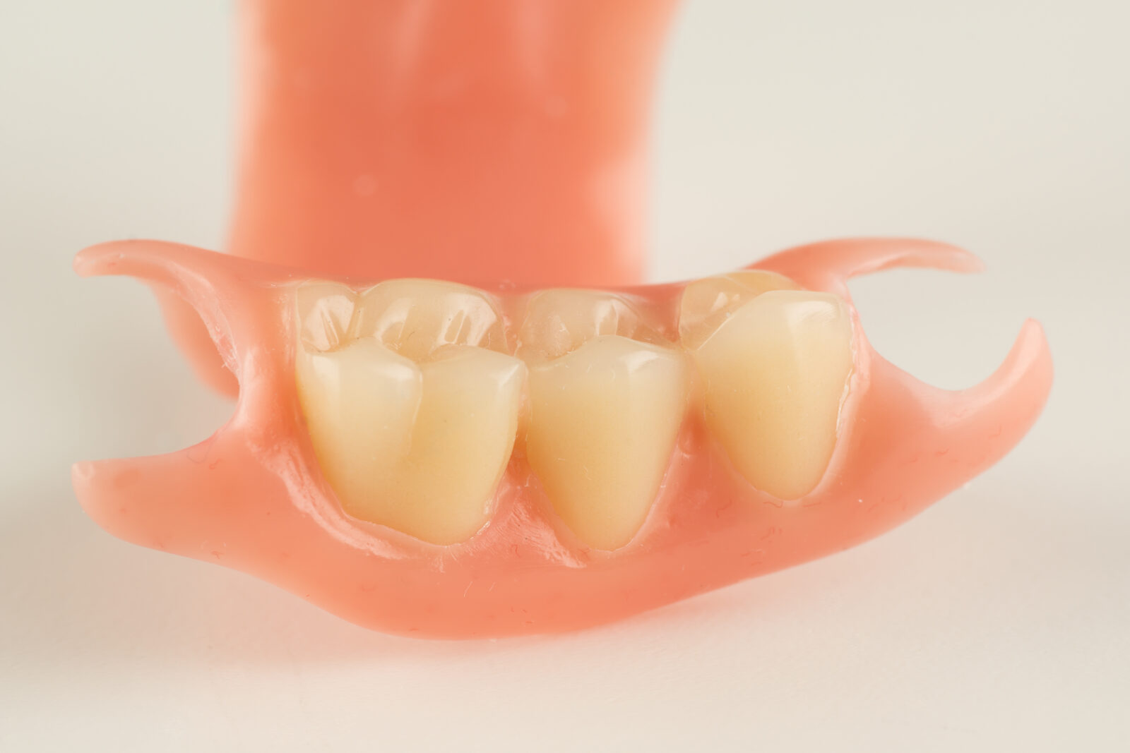 部分入れ歯(部分義歯)のイメージ